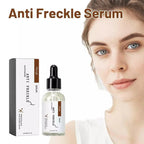 Anti Freckle Serum (30ml) - Zambeel
