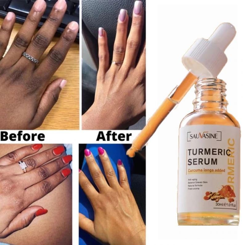 Beauty Lights Turmeric Serum (Original) - Zambeel